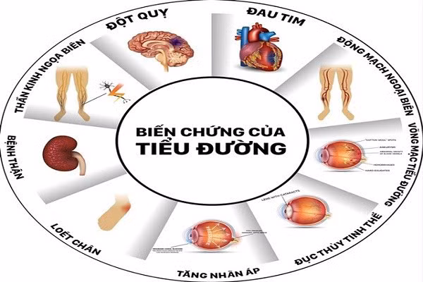 70% nguoi Viet khong biet minh mac benh tieu duong