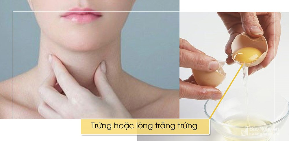 Lòng trắng trứng giúp đối phó với tình trạng viêm và đau cổ họng rất hiệu quả. Tuy nhiên, bạn nên tránh các món ăn có nhiều gia vị vì nó có thể làm cơn đau họng thêm trầm trọng.