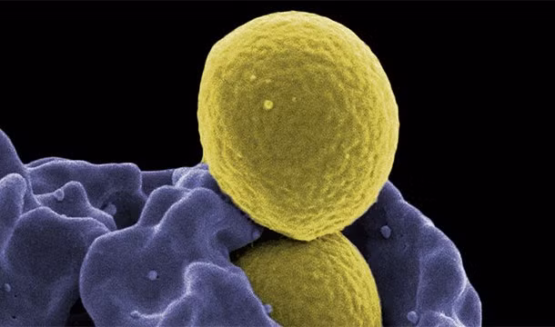 Một phần lý do của việc phụ nữ có tuổi thọ dài hơn nam giới là vì hệ miễn dịch của phụ nữ tốt hơn, lão hóa chậm hơn.