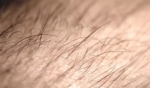 Thực tế có nhiều thứ sống trên da bạn hơn bạn tưởng tượng. Dân số của chúng thậm chí còn nhiều hơn cả dân số toàn cầu.