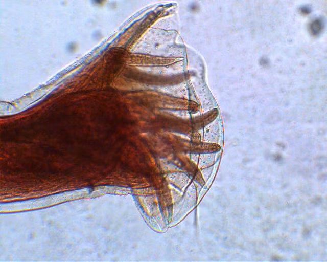 Đây thực sự là loài giun nguy hiểm bậc nhất thế giới bởi nó có thể gây ra những thương tổn vô cùng nghiêm trọng như thiếu máu, thiếu đạm, người hốc hác, suy tim, bụng sưng phồng do tràn dịch màng. Tuổi thọ của loài giun này chỉ rơi vào khoảng từ 4 đến 5 năm nhưng cả cuộc đời từ khi là trứng đến lúc trưởng thành, sinh sản, chết đi, loài giun móc này đều gây ra nỗi khiếp sợ cho người và động vật.