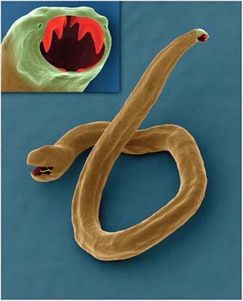 Nguy hiểm hơn, mặc dù giun móc "chinh chiến" hoành hành khắp cơ thể của người mắc bệnh nhưng bệnh nhân lại không có triệu chứng lâm sàng đặc hiệu mà chủ yếu là triệu chứng thiếu máu. Người nhiễm giun móc có da xanh, niêm mạc nhợt và đau vùng thượng vị tùy theo mức độ nhiễm giun. Để chữa bệnh giun móc, có thể dùng loại thuốc có tác dụng với nhiều loại giun, ít độc, dùng một liều duy nhất vẫn đạt hiệu quả cao như Albendazole và Mebendazole.