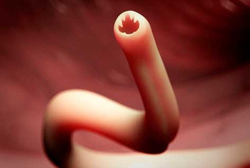 Loài giun móc nguy hiểm này sống ở trong tá tràng và ruột non của vật và người chúng ký sinh, chúng sử dụng hai móc lớn móc vào niêm mạc tá tràng hoặc ruột non, dùng hai răng nhỏ và hàm phía dưới cắn ngập vào niêm mạc và tiết ra một chất chống đông máu để hút máu.