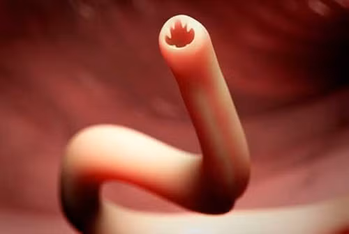 Loài giun móc nguy hiểm này sống ở trong tá tràng và ruột non của vật và người chúng ký sinh, chúng sử dụng hai móc lớn móc vào niêm mạc tá tràng hoặc ruột non, dùng hai răng nhỏ và hàm phía dưới cắn ngập vào niêm mạc và tiết ra một chất chống đông máu để hút máu.