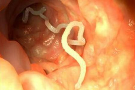 Sau khi ấu trùng giun móc chui qua da, chúng theo đường tĩnh mạch tới tim phải rồi đến phổi. Tại đây, ấu trùng giun chọc thủng mao mạch và phế nang, theo khí quản lên họng, đến thực quản, xuống dạ dày và ruột để phát triển thành giun trưởng thành, ký sinh ở tá tràng và ruột non và tiếp tục hút máu, sinh sản.