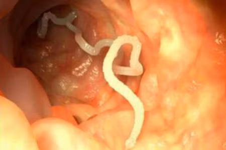 Sau khi ấu trùng giun móc chui qua da, chúng theo đường tĩnh mạch tới tim phải rồi đến phổi. Tại đây, ấu trùng giun chọc thủng mao mạch và phế nang, theo khí quản lên họng, đến thực quản, xuống dạ dày và ruột để phát triển thành giun trưởng thành, ký sinh ở tá tràng và ruột non và tiếp tục hút máu, sinh sản.