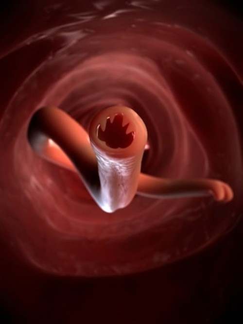 Giun móc cái trưởng thành sau khi giao phối, chúng đẻ trứng ở ruột non. Trứng giun móc theo phân thải ra ngoài nở thành ấu trùng giun. Ấu trùng giun xâm nhập vào cơ thể bằng cách chui qua da, nếu qua đường thức ăn hoặc nước uống thì vào thẳng ruột.