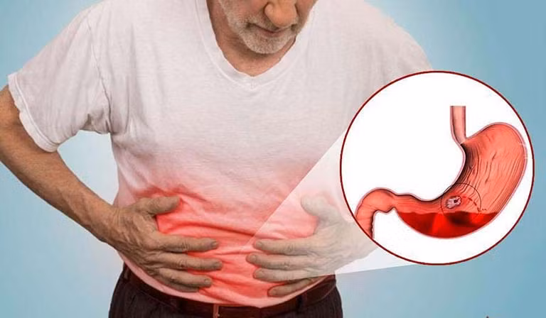 Phân đen, khó thở, đau ngực, đau bụng, ngất xỉu, máu nôn có thể có màu đỏ hoặc có thể có màu nâu sẫm là những dấu hiệu phổ biến của xuất huyết dạ dày. Ảnh: soytebackan.