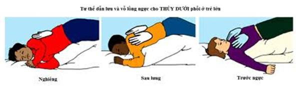 Bạn cũng có thể kết hợp vỗ rung ngực và dẫn lưu tư thế có thể giúp làm sạch đường hô hấp khỏi chất nhầy dư thừa. Ảnh: dieutridau.