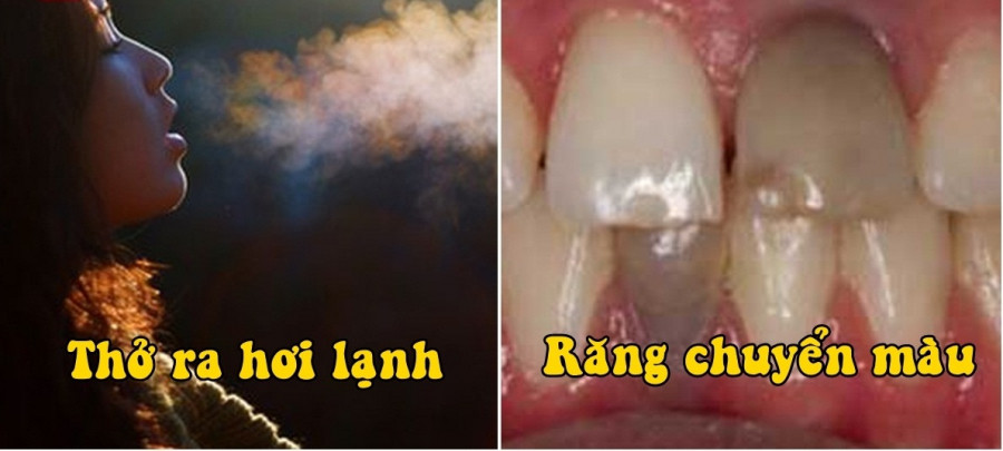 10 dau hieu tren co the canh bao ban sap gap chuyen chang lanh