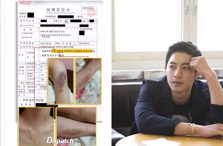 Nam ca sĩ kiêm diễn viên Kim Hyun Joong bị buộc tội đánh bạn gái đến mức gãy cả xương sườn và bị cô này đệ đơn kiện. Báo chí Hàn Quốc đưa tin, bạn gái Hyun Joong đệ đơn kiện anh này vì tội liên tục tấn công và bạo hành cô trong thời gian từ tháng 5 đến tháng 7/2014. Nhưng may mắn cho ngôi sao "Vườn sao băng", sau đó cô gái đệ đơn kiện bỗng rút đơn và nam ca sĩ kiêm diễn viên 28 tuổi nhẹ nhàng thoát tội.