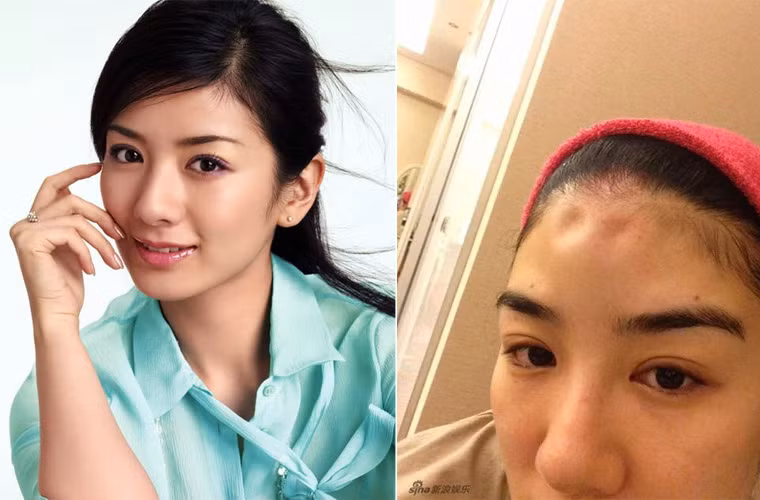 Tháng 6/2014, ngôi sao "Hoàn châu cách cách" Huỳnh Dịch đã lên blog tố người chồng thứ hai, doanh nhân Hoàng Nghị Thanh đánh đập và phủ nhận chuyện bồ bịch mà anh này bêu riếu mình trên blog. Đồng thời nữ diễn viên 35 tuổi đệ đơn ly hôn và đây là lần thứ hai cô đổ vỡ hôn nhân trong vòng một thời gian ngắn.