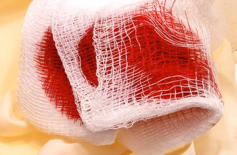 Bị ho ra máu lấy quả hồng sấy khô tán bột ngày dùng 3 lần, mỗi lần 3g sẽ cho tác dụng tốt. (Thông tin trong bài thuốc chỉ mang tính chất tham khảo, vui lòng hỏi ý kiến bác sĩ khi sử dụng.)