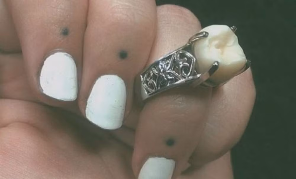 Chiếc nhẫn làm từ răng người: Đó là chiếc nhẫn đính hôn của cô nàng Carlee Leifkes. Ảnh: Boredpanda.