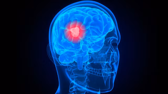 Ngoài ra, mắt của bạn cũng có thể mờ dần do có khối u trong vỏ não bị chấn thương vùng chẩm. Bệnh có thể khiến bệnh nhân bị mù dần.