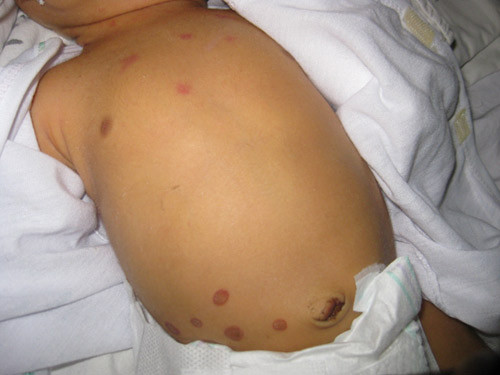 4 meo dan gian chua benh khung khiep me phai tranh xa-Hinh-2