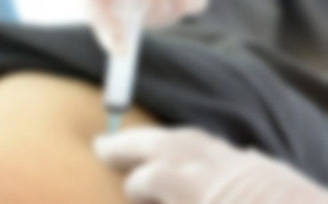 PGS.TS Vũ Ngọc Lâm, Giám đốc Trung tâm Phẫu thuật sọ mặt và tạo hình cho biết, khi đến BV TƯ Quân đội 108 thăm khám, vùng mông của bệnh nhân đã bị hoại tử rất nặng, loét sâu, chảy nhiều dịch mủ. Đáng lưu ý, vùng hoại tử đã lan xuống bẹn đùi, gây viêm mô mỡ.