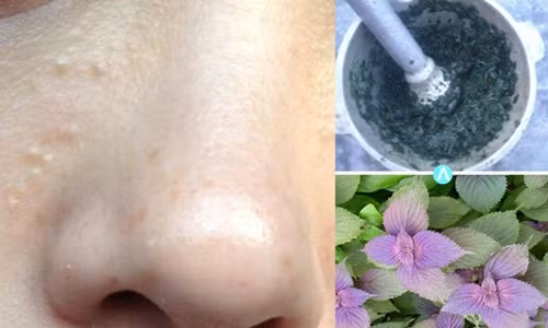 U50 cung tro nen tre dep sau vai lan dap thu nay