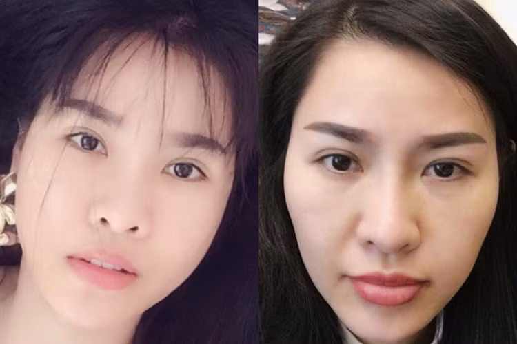 Loat anh Que Van "dap di lam lai" guong mat gay soc