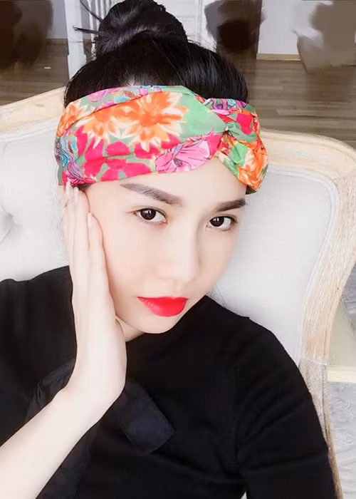 Tại Hàn Quốc, Quế Vân đã trải qua quá trình hạ gò má, gọt hàm, mở khóe mắt, độn silicon dưới khoé mũi, hút mỡ má, bắn laser vùng má và lấy mỡ từ đùi cho lên vùng dưới bọng mắt. Ảnh: FBNV