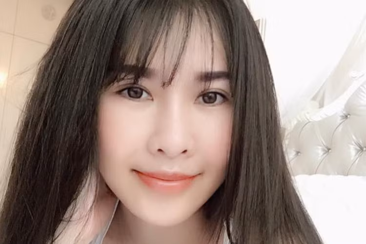 Hình ảnh Quế Vân sau khi dao kéo được hơn 1 tháng. Hiện tại, cô được nhận xét gương mặt thon gọn hơn, đôi mắt to hơn. Nói về chi phí phẫu thuật thẩm mỹ, Quế Vân cho hay cô đã bỏ ra 500 triệu đồng. Ảnh: FBNV