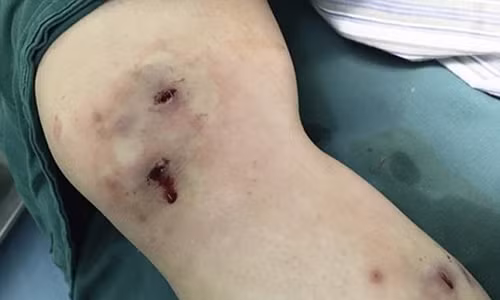 Hoang: Con gioi chui ra tu chan cua mot co gai