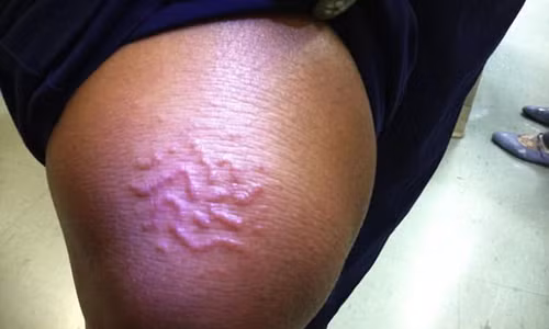 Di nghi mat ve, kinh hai thay giun bo ngoan ngheo duoi da