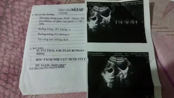 Chan doan sai suyt chet thai, BV muon gui thu xin loi-Hinh-2