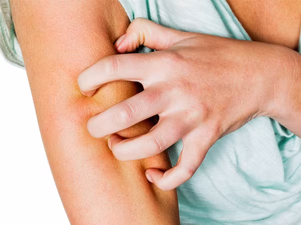 Da bạn trở nên nhạy cảm hơn, bạn hay bị ngứa ngáy ngoài da, dễ bị bầm thâm tím trên cơ thể thì cũng nên kiểm tra gan của mình vì chắc chắn nó không được khỏe.