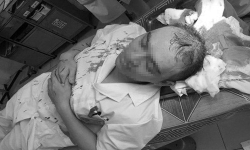 Tam su cua bac sy tung bi nguoi nha benh nhan hanh hung