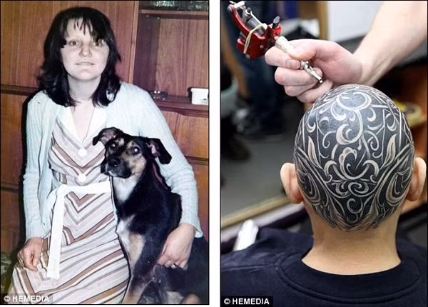 Cô gái này cũng là một bệnh nhân hói đầu. Cô đã chọn cách cạo tróc mái tóc của mình và thay thế bằng những hình xăm lạ mắt, ấn tượng. Ảnh: Hemedia.