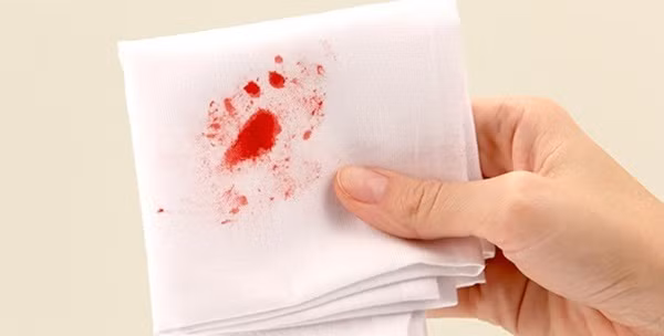 Sau phẫu thuật thì nguy cơ nhiễm trùng, nhiễm khuẩn biến chứng cũng rất lớn vì vùng hậu môn là cơ quan bài tiết nên rất khó giữ vệ sinh và làm vệ sinh thường xuyên. Ảnh: Sống khỏe.
