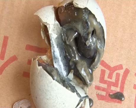 Nguyên nhân của hội chứng mùi cá là do tình trạng cơ thể bệnh nhân chứa một chất làm cho mùi nước tiểu, mồ hôi và hơi thở rất nặng, tanh và hôi thối khó chịu. Nguồn ảnh: Boldsky, Sun.