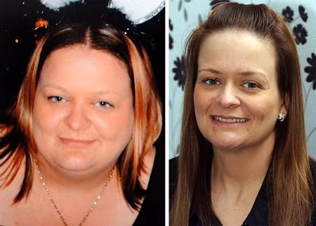 Cô từng bị một người phụ nữ ném cả thỏi kẹo cao su vào người và nói rằng cơ thể cô có mùi phân. Cũng vì mùi hôi khó ngửi mà cơ thể tiết ra, người phụ nữ này có lúc rơi vào tình trạng trầm cảm nặng, đã có ý định tự tử và phải nhờ đến sự trợ giúp của chuyên viên tư vấn tâm lý.