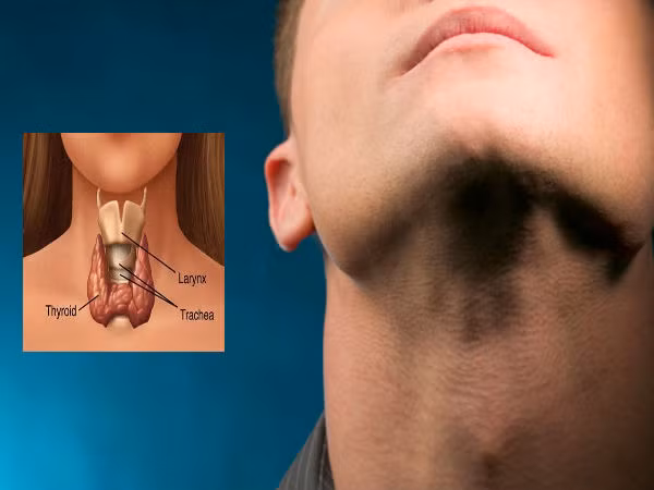 Nếu lưỡi của bạn lớn hơn bình thường và hơi nhô ra ngoài điều này chứng tỏ tình trạng sức khỏe tuyến giáp của bạn không được tốt, rất có thể hormon tuyến giáp của bạn không đủ. Đây còn được gọi là bệnh lưỡi sói.