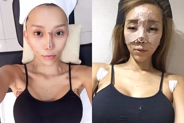 Mới đây, Leng Yein bất ngờ gây sốc với các fan khi công khai loạt ảnh dao kéo, chỉnh sửa mũi và nâng ngực lên mạng. Loạt ảnh được công khai trong những ngày đầu tiên của năm mới 2015 và được hot DJ mô tả bằng dòng viết: ""Năm mới. Khuôn mặt mới. Khởi đầu mới". 