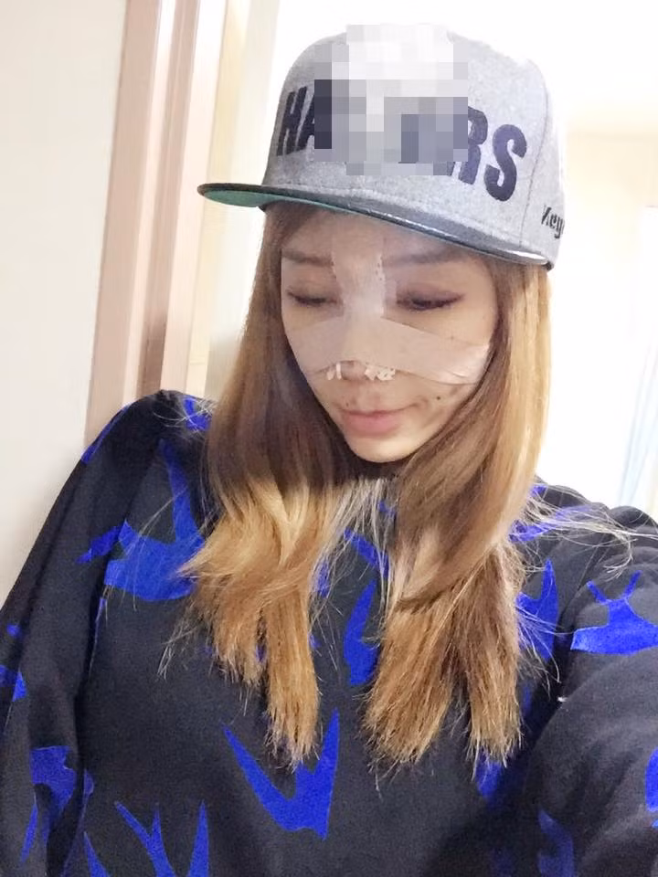 Trong khoảng 10 năm qua, nữ DJ Leng Yein đã trải qua 10 lần phẫu thuật thẩm mỹ. Khuôn mặt của cô hoàn toàn thay đổi sau một lần dao kéo và khiến các fan phải ngỡ ngàng. 