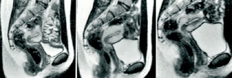 Hinh anh khi lam 'chuyen ay' trong may chup cong huong tu