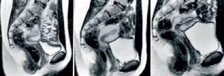 Hinh anh khi lam 'chuyen ay' trong may chup cong huong tu