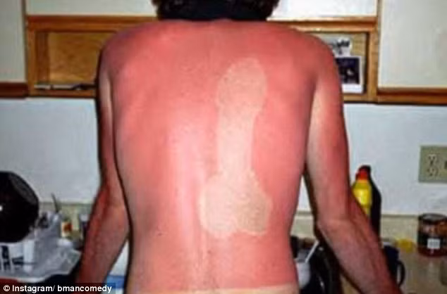 Tiến sĩ Barney Kenet, một chuyên gia da liễu tại New York cho hay trào lưu này có thế dẫn đến da cháy nắng toàn thân, nhẹ thì gây tàn nhang, nếp nhăn sớm, về lâu dài sẽ gây ung thư da.