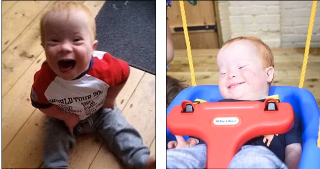 Mẹ bé cũng cho hay, Jack là cậu bé tuyệt vời và là hạnh phúc của gia đình mà họ muốn chia sẻ với thể giới. Những bức ảnh mà bố mẹ cậu bé đăng lên mạng xã hội để chứng tỏ rằng cậu bé có cuộc sống bình thường mặc dù gặp phải khuyết tật không may mắn.