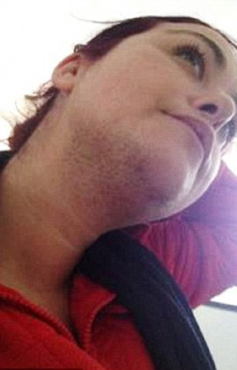 Khi còn bé, cô từng bị bắt nạt nhiều tại trường học và bị đặt biệt danh Gorilla Cheryl do cơ thể có nhiều lông. Thậm chí, tình trạng của Cheryl còn bị chế giễu trên internet.