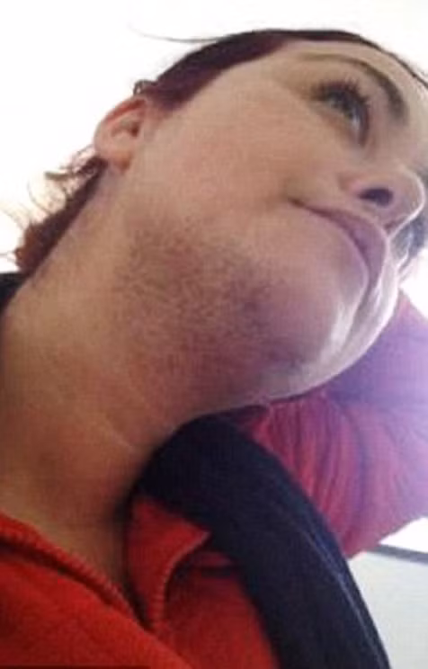 Khi còn bé, cô từng bị bắt nạt nhiều tại trường học và bị đặt biệt danh Gorilla Cheryl do cơ thể có nhiều lông. Thậm chí, tình trạng của Cheryl còn bị chế giễu trên internet.