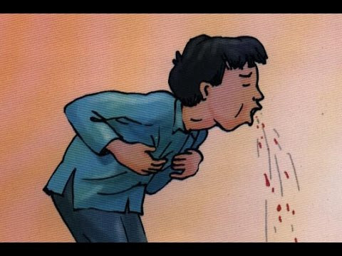 Đầu tiên, ho ra máu có thể ở mức độ nhẹ; nhưng nếu không biết chăm sóc sẽ dẫn đến nặng dần. Ngay khi ho ra máu nhẹ, lượng máu ho ra ít, người bệnh đã phải nằm nghỉ ngơi, hạn chế vận động. Phải có cốc đựng ở ngay bên cạnh để thuận tiện khi sử dụng. Không được nuốt vì máu vào dạ dày sẽ có thể gây nôn.