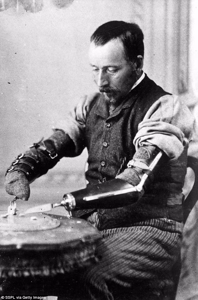 Sau đó, vào những năm 1900, hàng trăm lính quân đội bị tàn tật từ cả 2 cuộc thế chiến đã đặt tay chân giả của Gillingham.