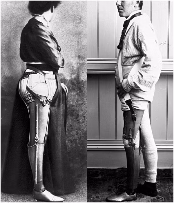 Được đặt biệt danh là The Leather Leg (chân giả da). Phải mất 10 ngày để chế tạo ra bộ chân giả da này.