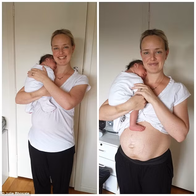 Một tuần sau sinh, chiếc bụng đã có phần giảm độ căng, kéo theo phần da nhăn nhúm bắt đầu xuất hiện.