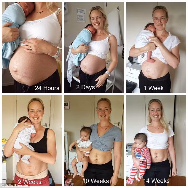 Cô Julie Bhosale, sống tại New Zealand mới đây đã dũng cảm tiết lộ những bức ảnh về vòng bụng phệ sau khi sinh nở chân thật nhất của mình. Những hình ảnh của cô Julie có thể sẽ khiến không ít bà mẹ khác tự ti về vòng eo sau khi sinh của mình và với những người đang bầu bí thì sẽ chịu áp lực nặng nề làm thế nào để có thể eo thon ngay sau sinh, thậm chí có thể “choáng” với chiếc bụng phệ ngay sau ca sinh nở.