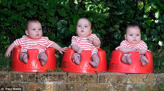 Lạ lùng ca sinh ba có 2 bé chung nhau thai và bọc ói