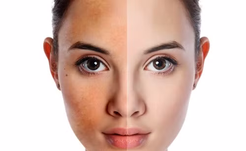 Da xỉn màu. Dù mong mỏi một làn da tươi trẻ, căng tràn như thế nào, nếu giữ nguyên lớp trang điểm khi đi ngủ, cái nhận được chỉ là một làn da xỉn màu và bị khô. Da cần được thở vào buổi tối để toạ ra các vitamin và chất khoáng giúp tạo nên một làn da khoẻ mạnh rạng người. Trong khi đó, nếu các lỗ chân lông bị che kín, khả năng phục hồi này sẽ phải mất rất nhiều thời gian.